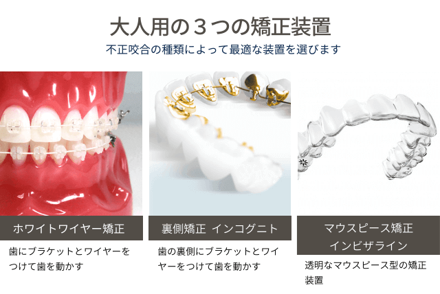 大人用の３つの矯正装置