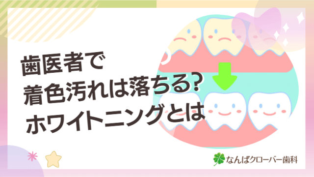 歯医者で着色汚れは落ちる？ホワイトニングとは