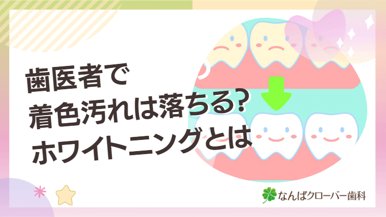 歯医者で着色汚れは落ちる？ホワイトニングとは