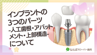 オッセインアグレーテッド インプラントとその概念【裁断済】 オッセインアグレーテッド インプラントとその概念【裁断済】 本