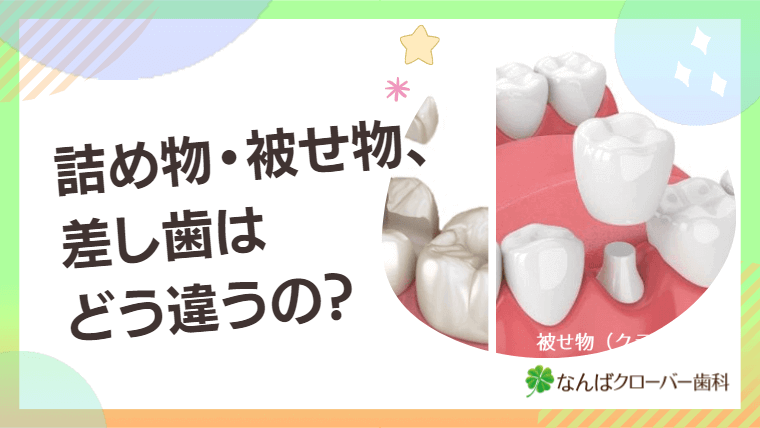 詰め物・被せ物、差し歯はどう違うの？