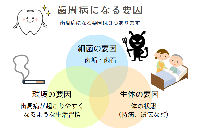 歯周病の3つの要因