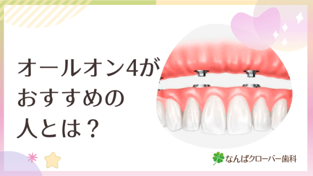オールオン4がおすすめの人とは？