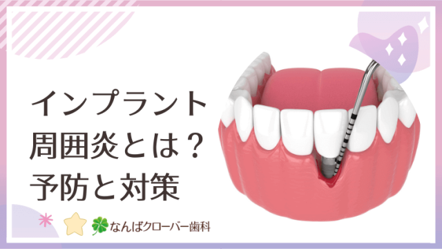 インプラント周囲炎とは？予防と対策
