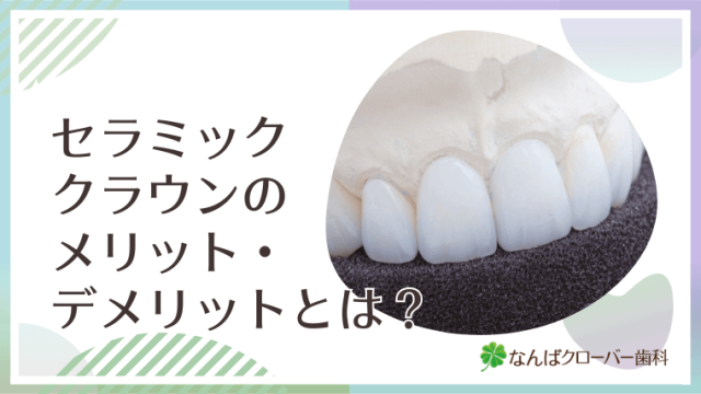 セラミッククラウンのメリット・デメリットとは？