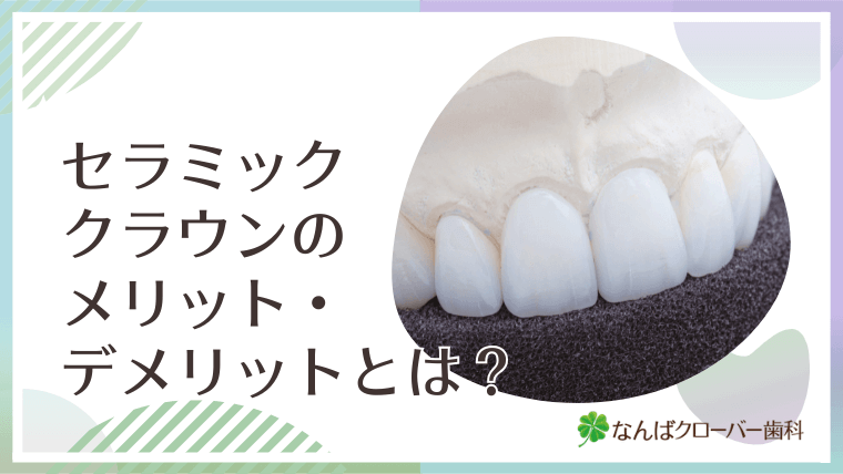 セラミッククラウンのメリット・デメリットとは？