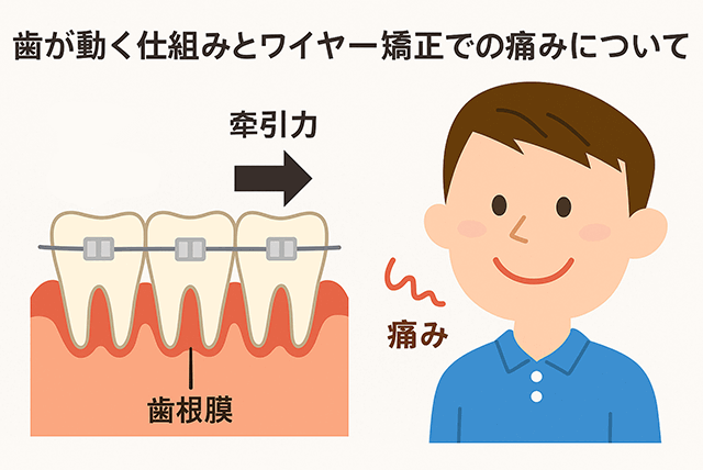 痛みについて