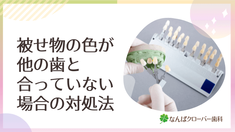 被せ物の色が他の歯と合っていない場合の対処法