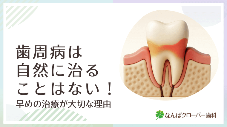 歯周病は自然に治ることはない！早めの治療が大切な理由