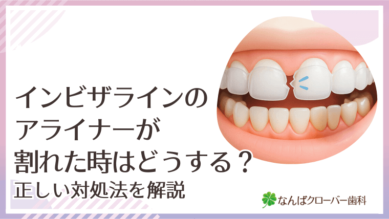 インビザラインのアライナーが割れた時はどうする？正しい対処法を解説