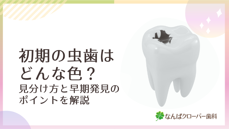 初期の虫歯はどんな色？