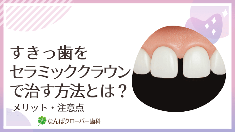 すきっ歯をセラミッククラウンで治す方法とは？
