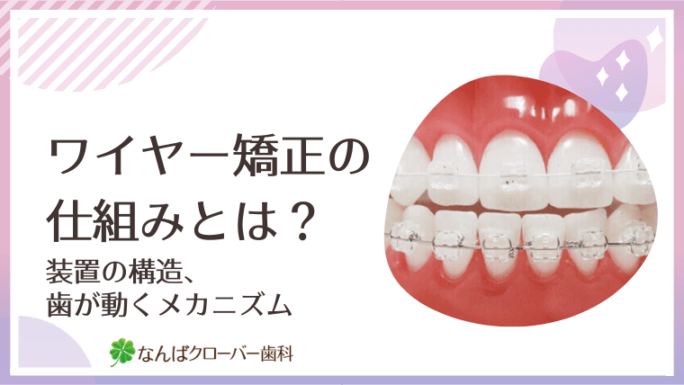 ワイヤー矯正の仕組みとは？