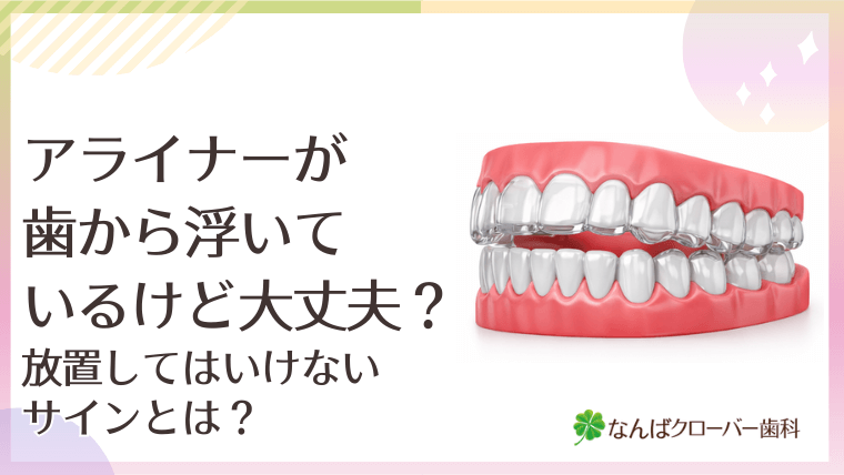 アライナーが歯から浮いているけど大丈夫？放置してはいけないサインとは