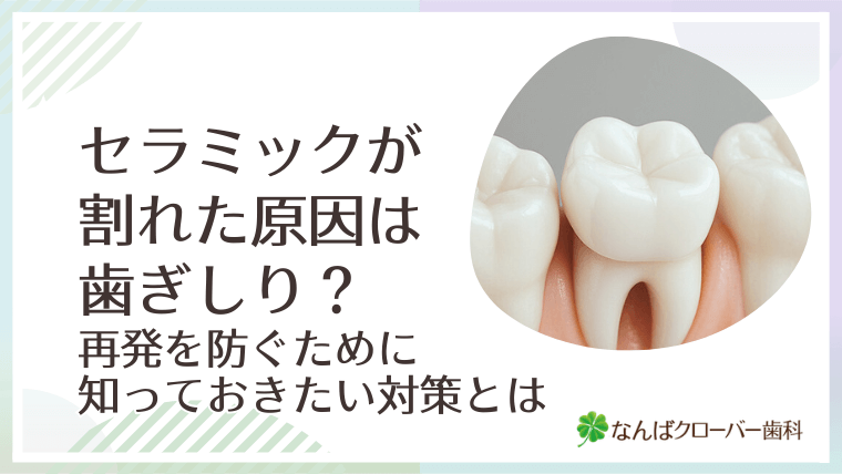 セラミックが割れた原因は歯ぎしり？再発を防ぐために知っておきたい対策とは