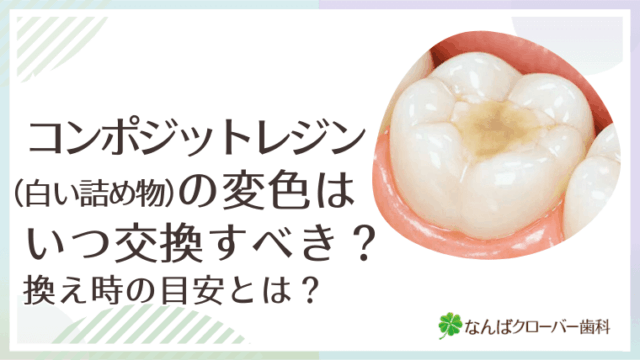 コンポジットレジン（白い詰め物）の変色はいつ交換すべき？換え時の目安とは？