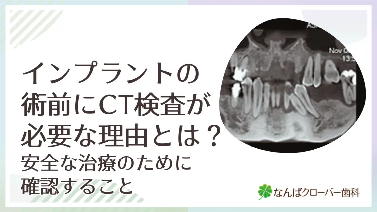 インプラント術前にCT検査が必要な理由とは？安全な治療のために確認すること